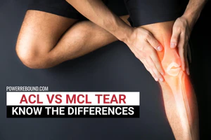 ACL vs MCL Tear: Know the Differences