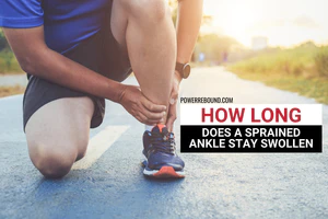 How Long Does a Sprained Ankle Stay Swollen?