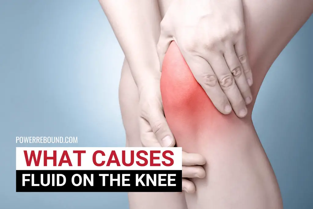 What Causes Fluid on the Knee?