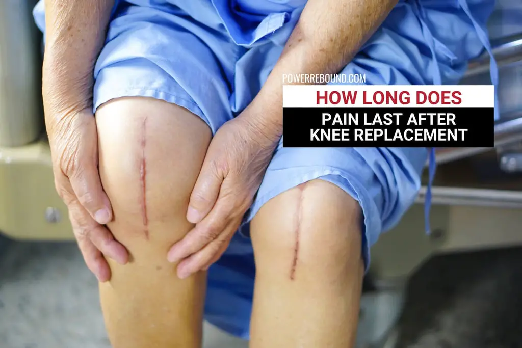 How Long Does Pain Last After Knee Replacement: What to Expect